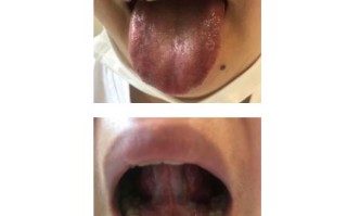 黑暗之魂3发青的舌头在哪里获得_黑暗之魂3发青舌头在哪
